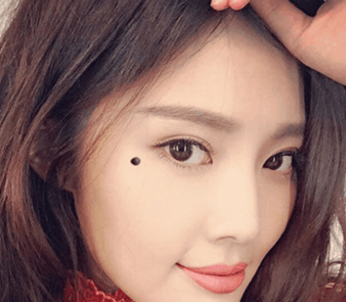脸上的痣可以随便点吗 女人脸上十大吉痣